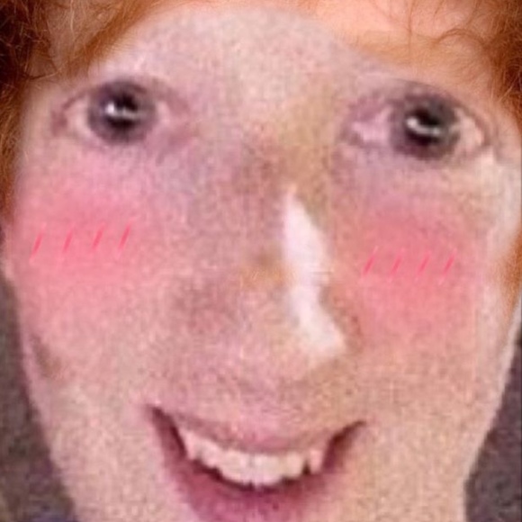 dry_wet_wipes